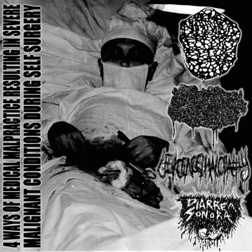 Inhalando Cerebro Seco De Perro : 4 Ways of Medical Malpractice Resulting in Severe Malignare Malignant Conditions During nt Condition